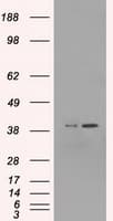 MAPK1 / ERK2 Antibody (clone OTI6E5)