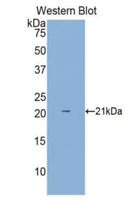 CD8A / CD8 Alpha Antibody (aa22-198, Biotin)
