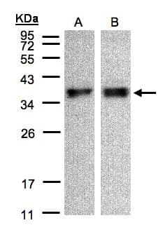 ZPBP / SP38 Antibody (aa29-275)