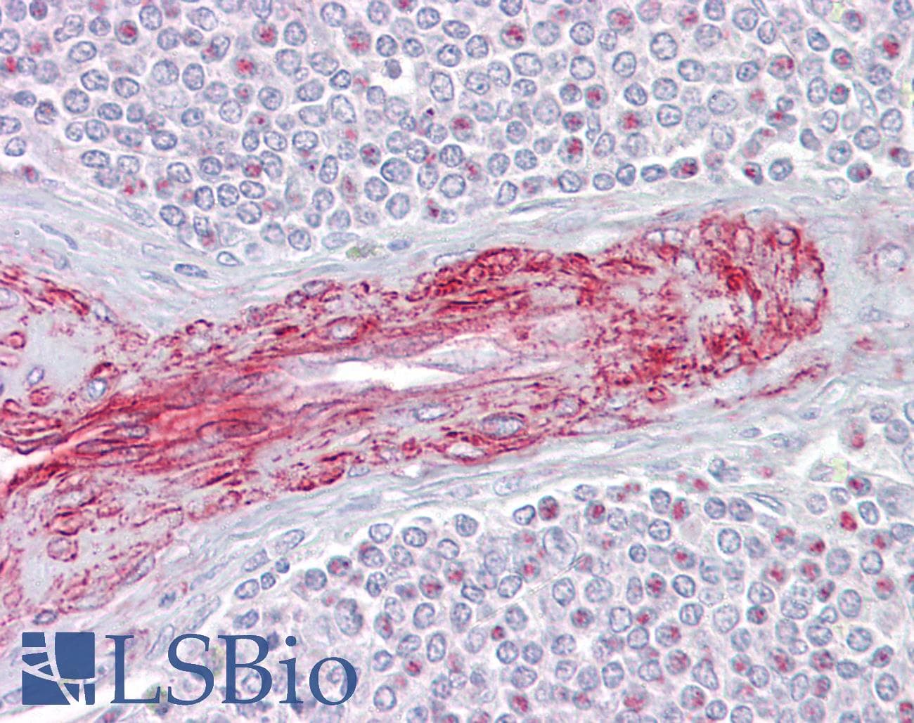 SLA Antibody (C-Terminus)