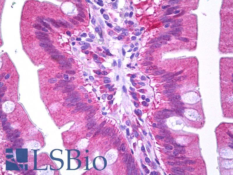IHC-plus™ EIF2S1 Antibody (aa21-70)