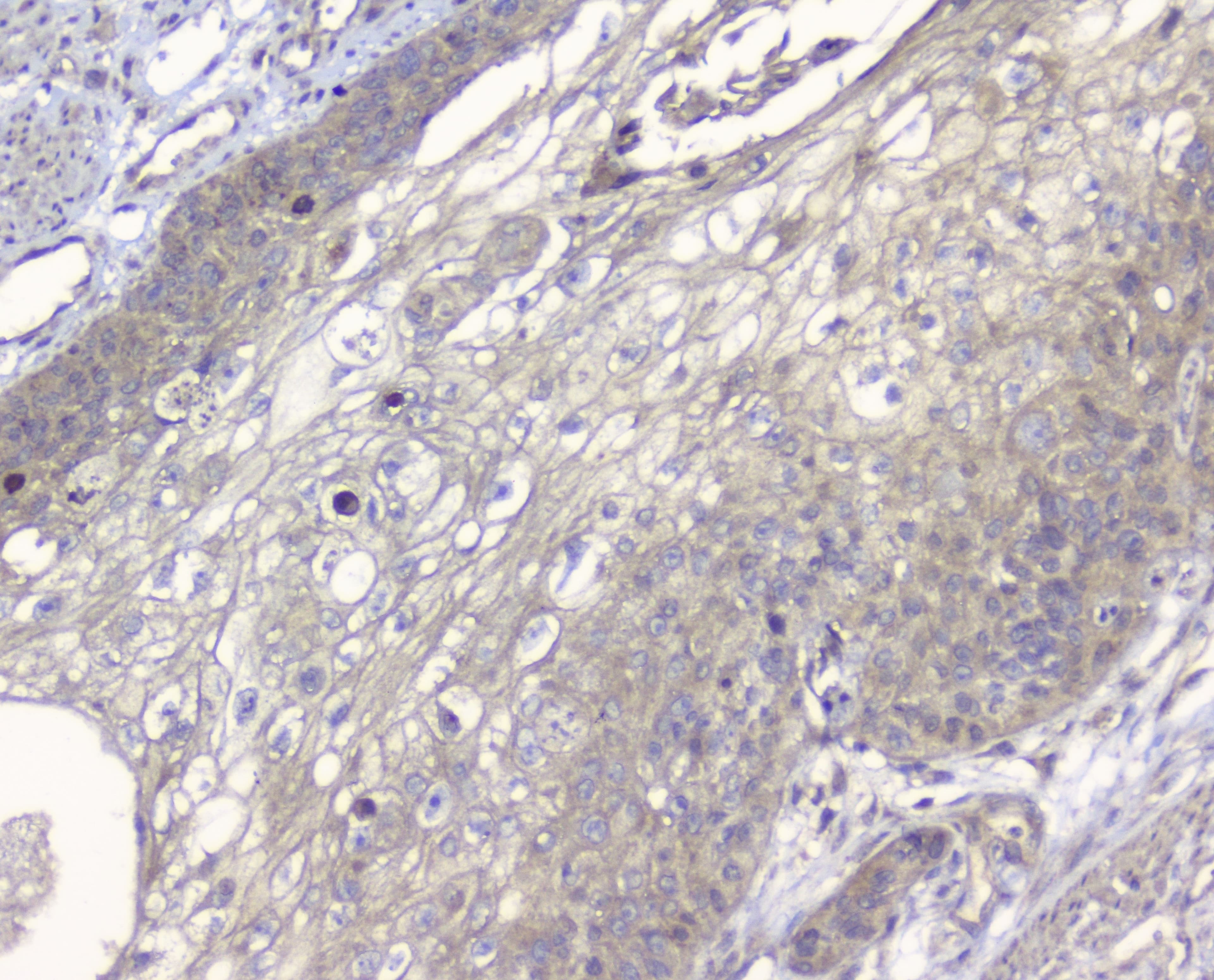 PDCD6IP / ALIX Antibody (aa2-330)