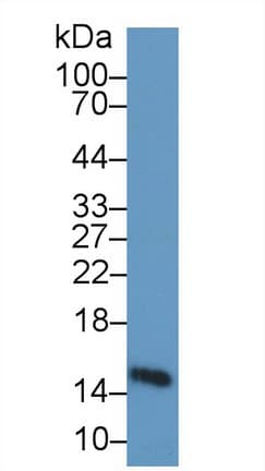 FABP3 / H-FABP Antibody (aa1-133)