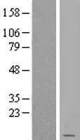 CBT1 / SDHD Protein (Over-Expression Lysate Myc-DDK (Flag))
