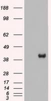 MAP2K2 / MKK2 / MEK2 Antibody (clone OTI5F6)