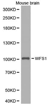 IHC-plus™ Polyclonal Rabbit anti-Human WFS1 Antibody (IHC, WB)