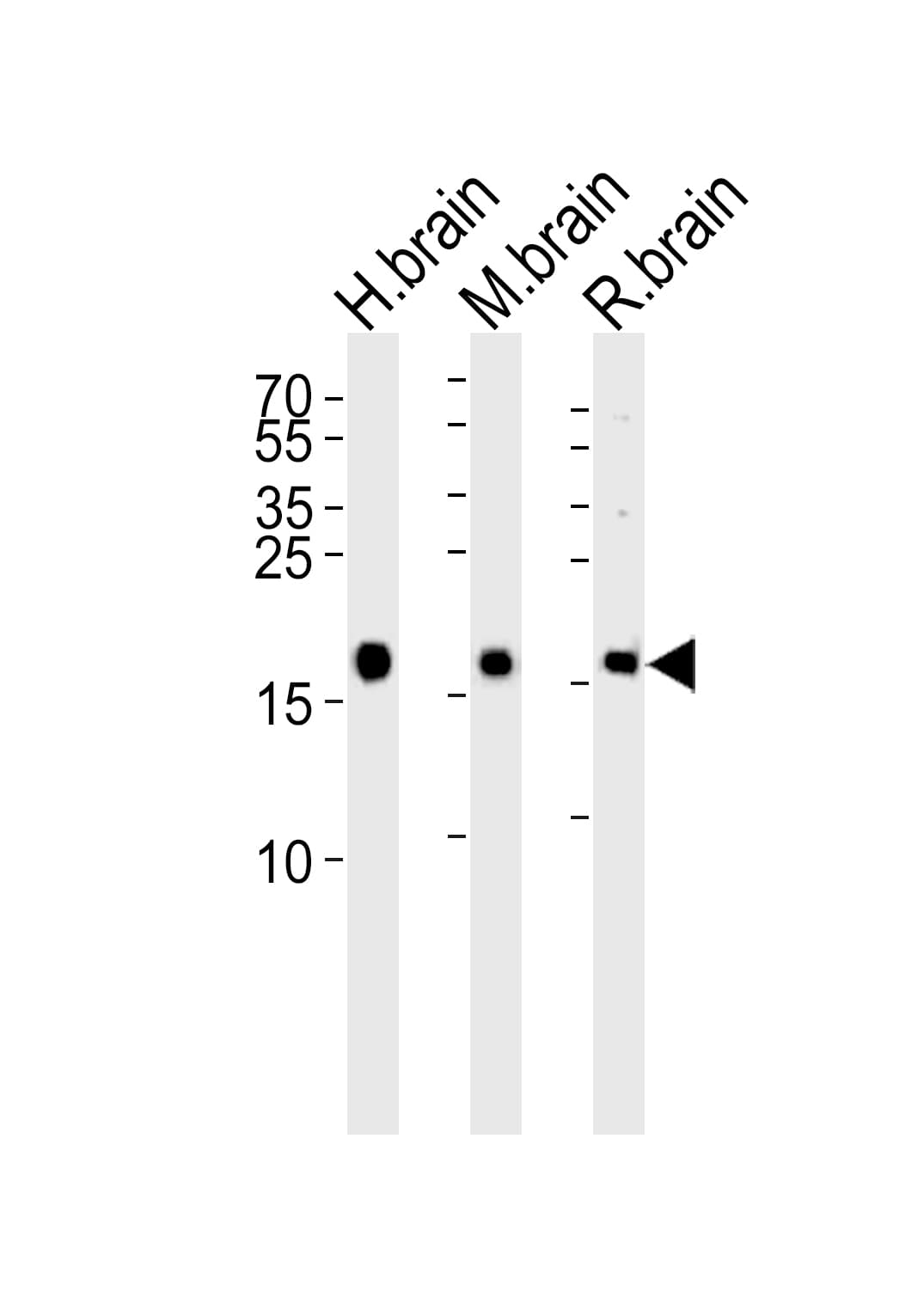 VILIP / VSNL1 Antibody (aa123-150)
