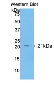 FGA / Fibrinogen Alpha Antibody (aa77-244)