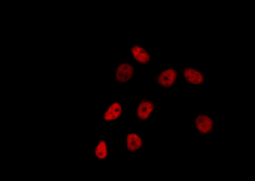 FEV / PET1 Antibody