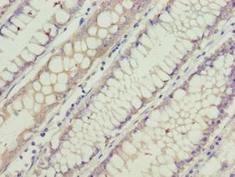 Polyclonal Rabbit anti-Human GCSAML / C1orf150 Antibody (IHC)