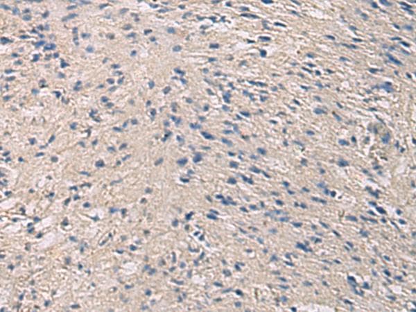 PRKCSH Antibody