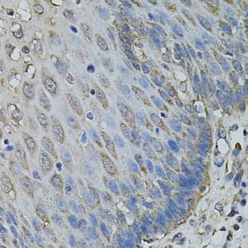 IL1A / IL-1 Alpha Antibody