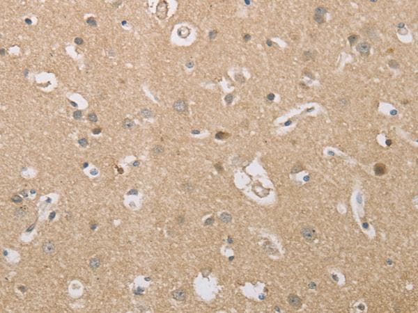 P2RY11 / P2Y11 Antibody