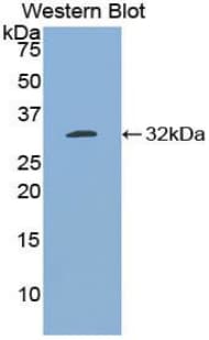 BCL3 / BCL-3 Antibody (aa82-341)