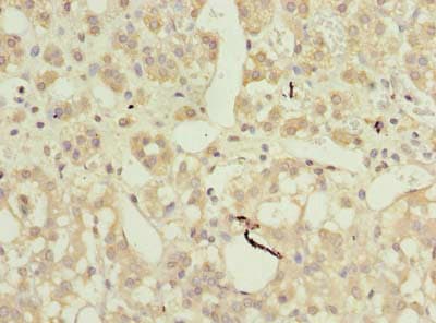 AP4B1 Antibody