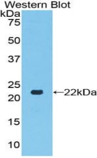 TLR7 / CD287 Antibody (aa887-1036)