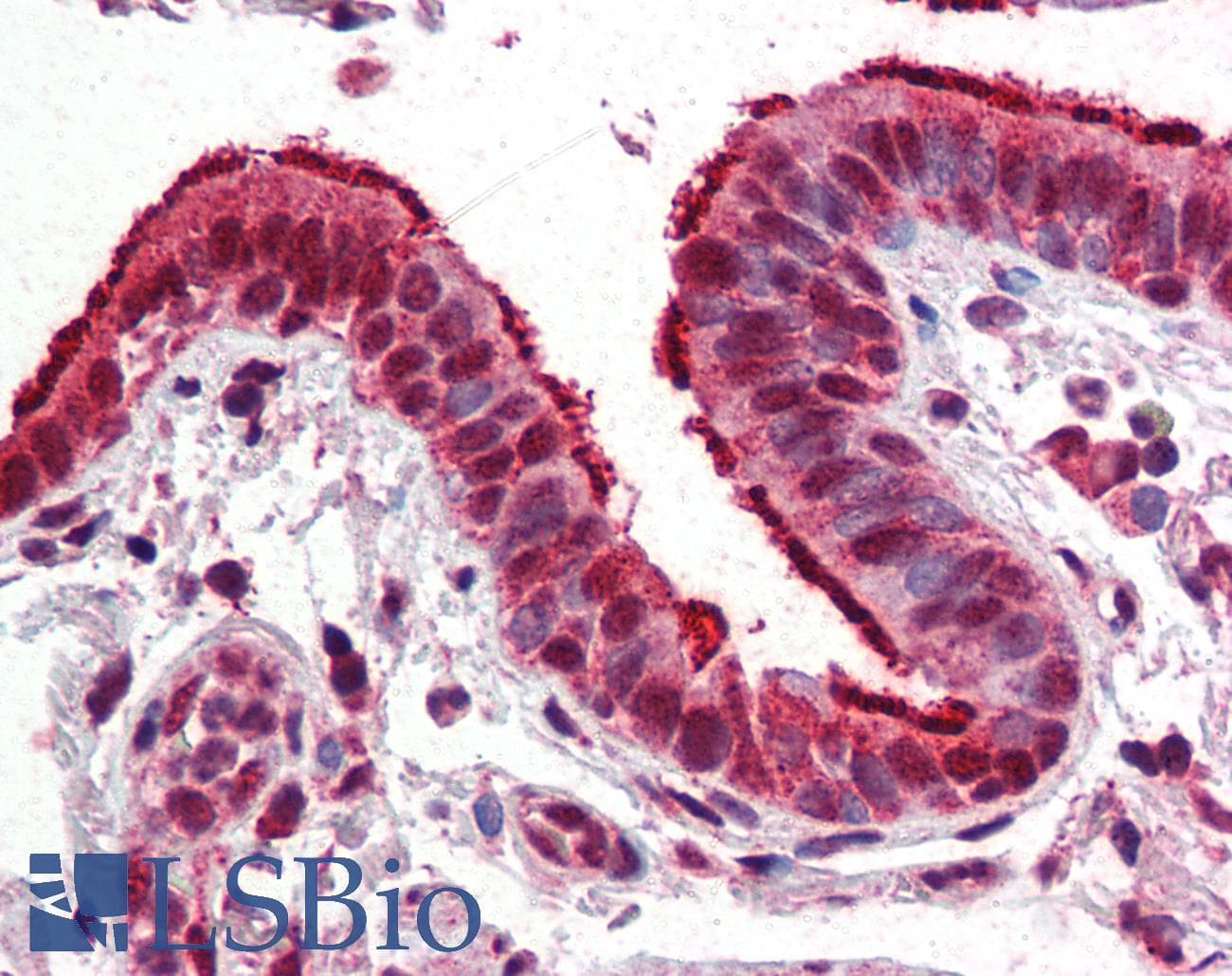 PathPlus™ Monoclonal Mouse anti-Human FOXP1 Antibody (clone JC12, IHC, WB)