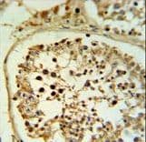 FSCN3 Antibody (aa1-30)