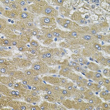 AQP5 / Aquaporin 5 Antibody