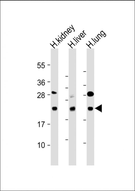 BCL2L10 / Diva Antibody (Internal)