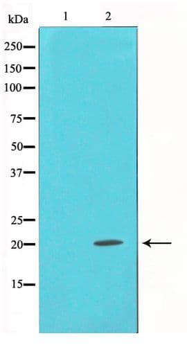 SNCA / Alpha-Synuclein Antibody