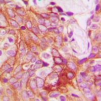 PRKCB / PKC-Beta Antibody (C-Terminus)