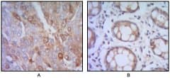 ST13 Antibody (clone 3B10)