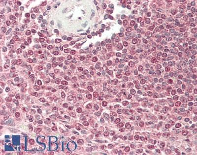 IHC-plus™ RP105 / CD180 Antibody (Internal)