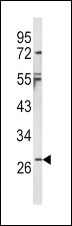 IL-1B / IL-1 Beta Antibody (aa148-174)