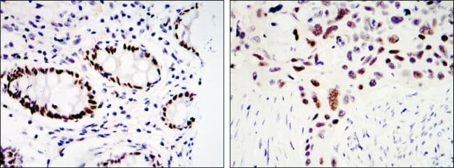 KLF4 Antibody (clone 1000000)