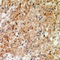 Polyclonal Rabbit anti-Human SYT1 + SYT2 Antibody (IHC, WB)