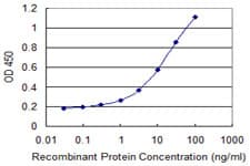IHC-plus™ Monoclonal Mouse anti-Human EIF2S3 / EIF2G Antibody (clone 1H3, IHC, WB)