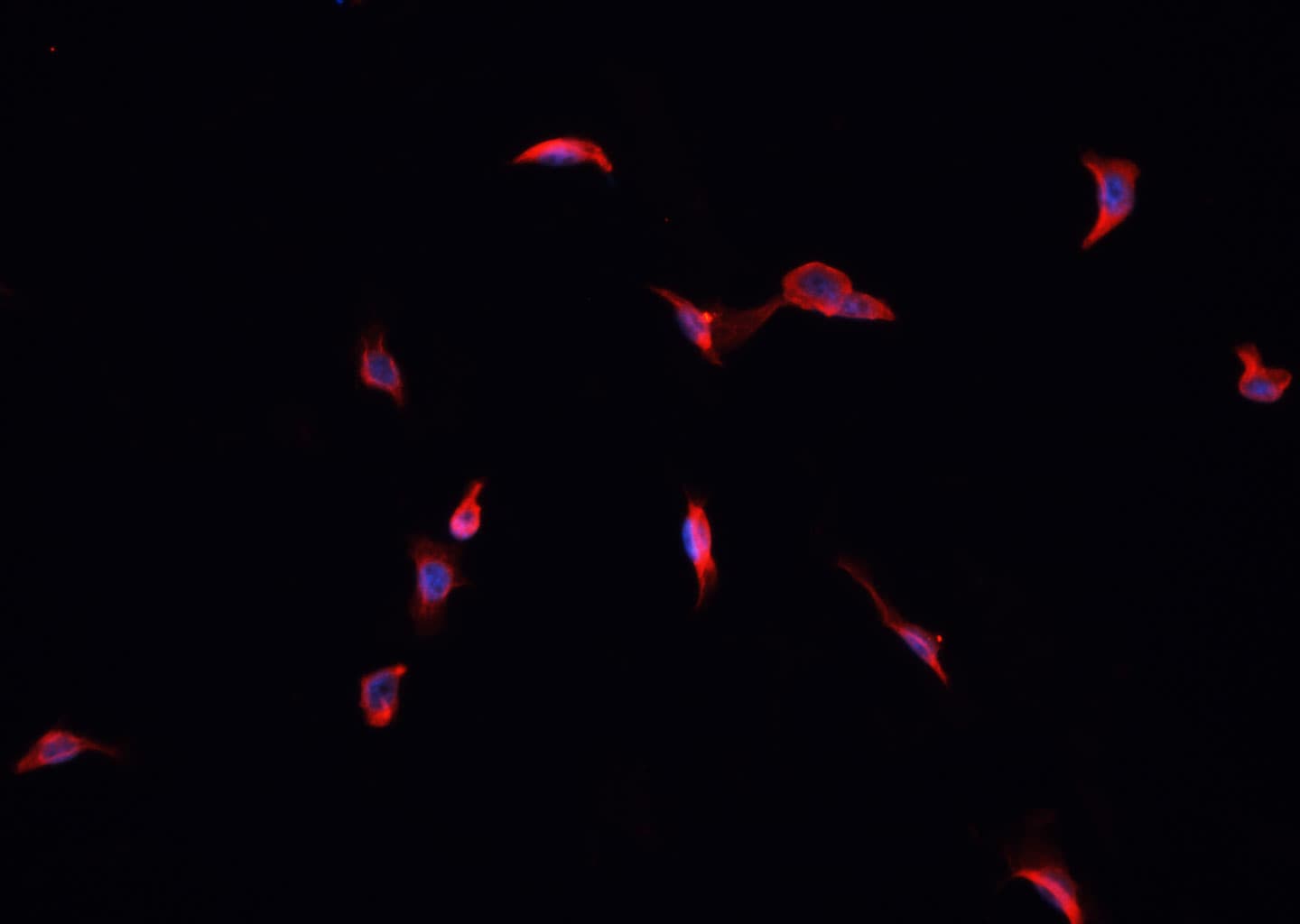 GPX4 / MCSP Antibody