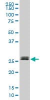 Monoclonal Mouse anti-Human TGIF2 Antibody (clone 2F3, WB)