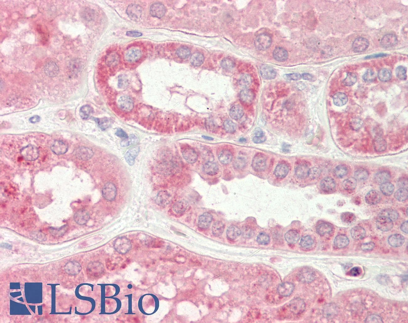 IHC-plus™ STIM2 Antibody (C-Terminus)