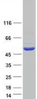 Human DLST / E2 Protein (Recombinant Myc-DDK (Flag))