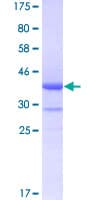 Human B4GALT5 Protein (Recombinant GST, N-terminus)