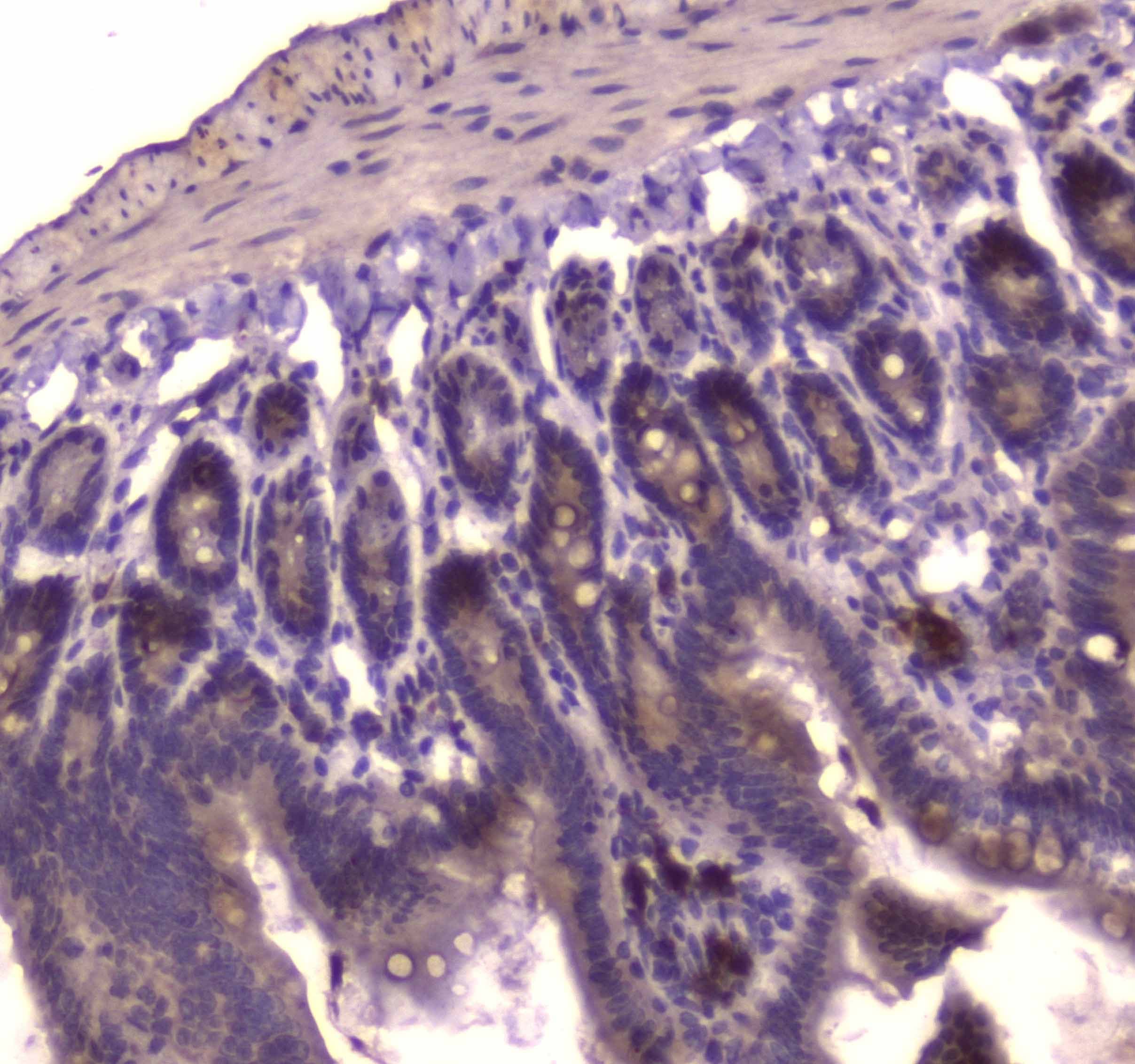 IGF2R / CD222 Antibody