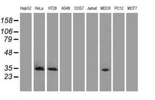 Monoclonal Mouse anti-Human CDK5 Antibody (clone OTI2H6, IF, WB)