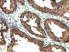 EPHX2 / Epoxide Hydrolase 2 Antibody (clone OTI1A6, Carrier-free)