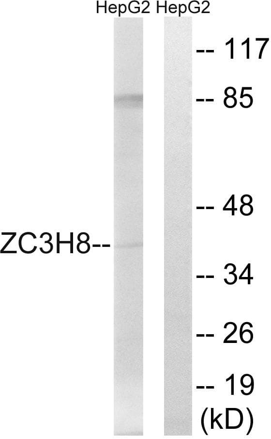 Polyclonal Rabbit anti-Human ZC3H8 Antibody (IHC, WB)