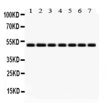 IDH2 Antibody (aa413-447)