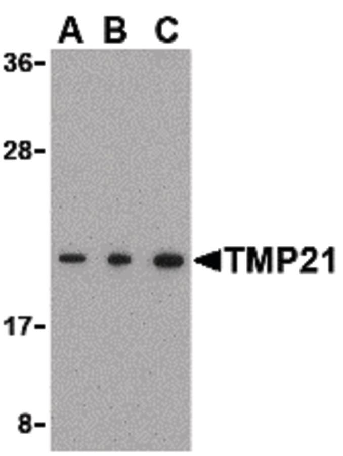 IHC-plus™ TMED10 / TMP21 Antibody
