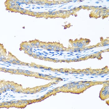 TAC1 Antibody