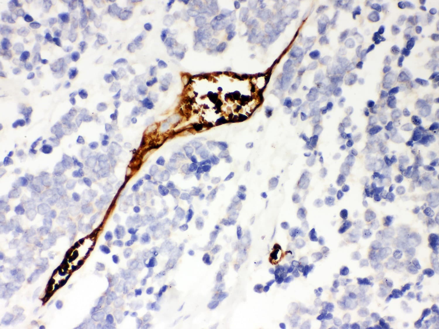 MSLN / Mesothelin Antibody (aa306-576)