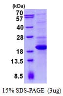 Human TTC32 Protein (Recombinant His)