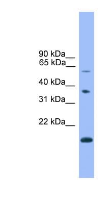 Polyclonal Rabbit anti-Human NOTCH4 Antibody (C-Terminus, WB)