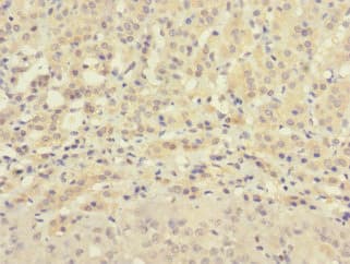 ZNF462 Antibody