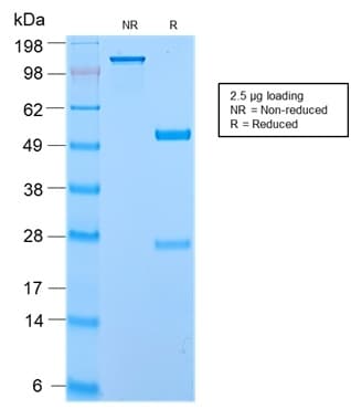 Recombinant Monoclonal Rabbit anti-Human ECM1 Antibody (clone ECM1/2889R, Azide-free,Carrier-free, IHC)