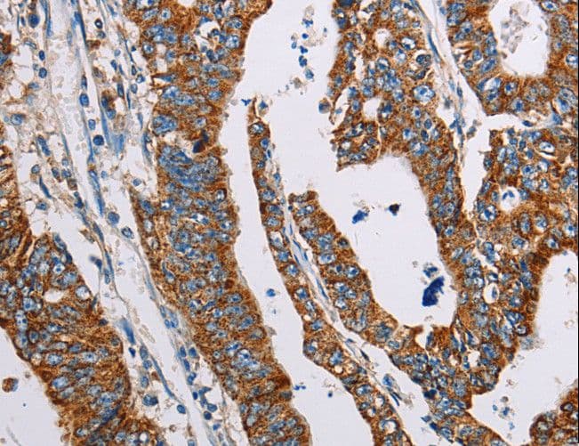 ALG2 Antibody